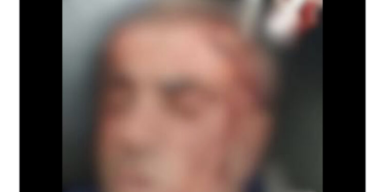 FOTO/ Polici u dhunua para banesës, Berisha ndan pamjet: I kanë çarë kokën, krimi mbahet i fshehtë