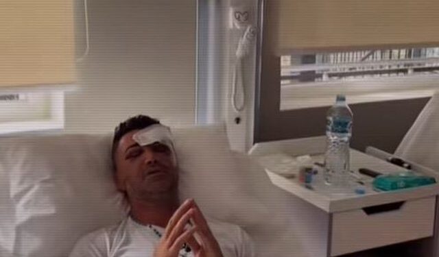 U përfshi në aksident të frikshëm me familjen, Kristian Boçi: Kam humbur shikimin në njërin sy