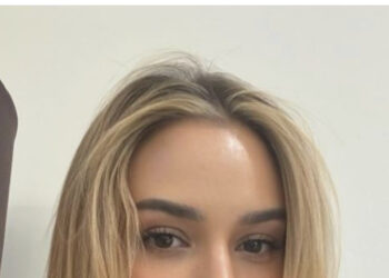 Bora bën ndryshimin drastik në pamje, fansat vërshojnë në ‘lum’ kritikash