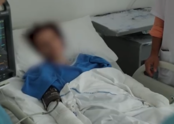 Dhëndri tentoi ti digjte të gjallë vajzën në Korçë, flet e ëma Melisës: Do e djeg siç dogji vajzën time