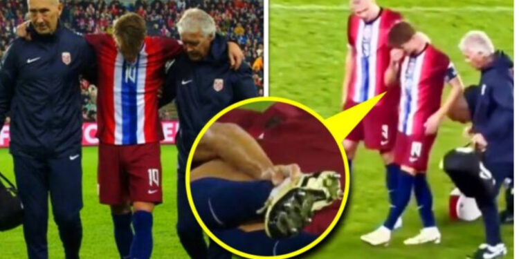 U dëmtuan në Ligën e Kombeve, Odegard do të mungojë për një kohë të gjatë në fushën e lojës