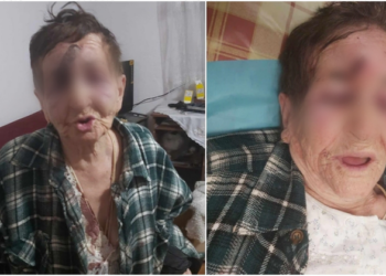 ‘Më goditi me shkop, më mbuloi gjaku. Pastaj më zhveshi…’ zbardhet dëshmia tronditëse e 82 vjeçares