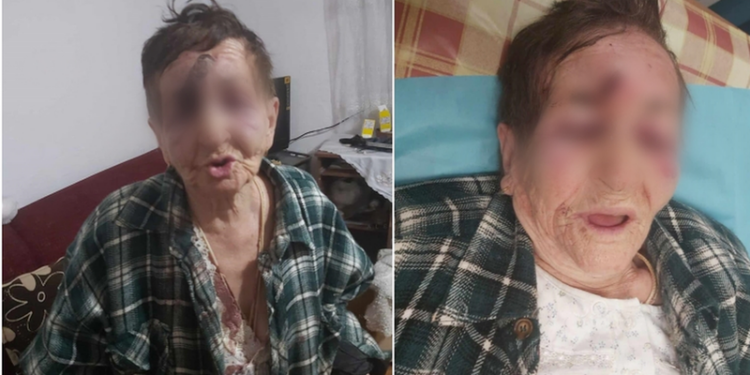 ‘Më goditi me shkop, më mbuloi gjaku. Pastaj më zhveshi…’ zbardhet dëshmia tronditëse e 82 vjeçares