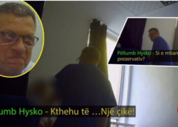SKANDALI/ Mjeku ngacmon sek*ualisht pacienten dhe i kërkon se*s: Do ta d*rdh në gojë (Kujdes, video dhe fjalor +18)