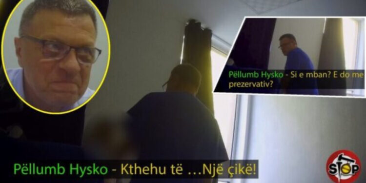 SKANDALI/ Mjeku ngacmon sek*ualisht pacienten dhe i kërkon se*s: Do ta d*rdh në gojë (Kujdes, video dhe fjalor +18)