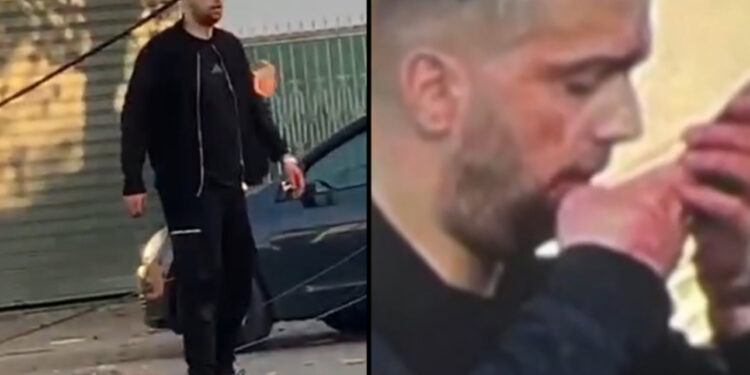 PAMJET / I gjakosur dhe i përhumbur pranë trupit të pajetë të vëllait, Ibrahim Lici dyshohet se ishte në makinë gjatë atentatit!