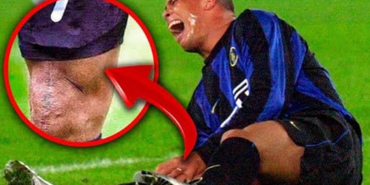 Braziliani Ronaldo tregon fillimin më brutal të karrierës së tij ndaj një mbrojtësi që vishte këpucë me thumba të gjatë