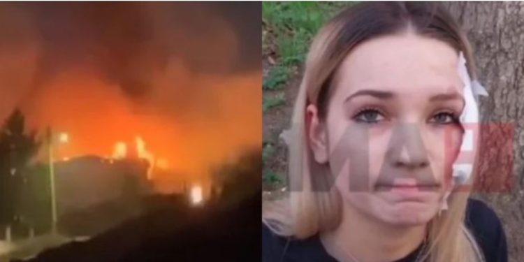 “Të gjithë përpiqeshin të shpëtonin veten”, 20-vjeçarja që i mbijetoi zjarrit në Koçan: Motra ime ka humbur, nuk po e gjejmë në asnjë spital!