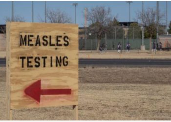 Shokuese në Teksas! Ndërrojnë jetë nga fruthi dy fëmijë pas shpërthimit të virusit