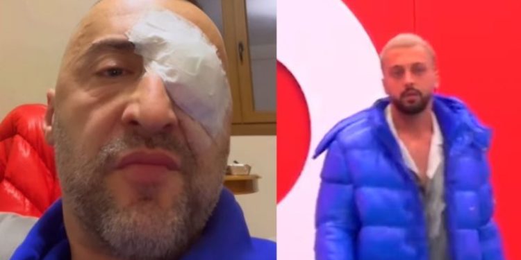 “O yll, o dritë sa do durosh më shumë”/ G-Bani shfaqet i përlotur, i del në krahë Gjestit: Nuk e meritoje, kam bërë gabim që…