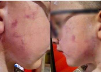 Kthehet dhuna në kopshtin Gledis! Nëna dërgon djalin shëndoshë dhe e merr të nxirrë