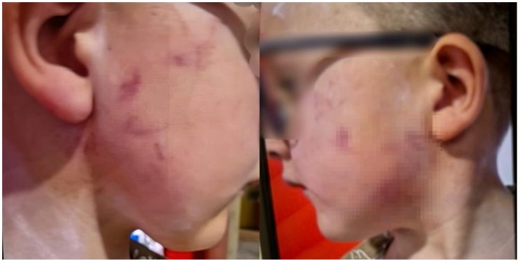 Kthehet dhuna në kopshtin Gledis! Nëna dërgon djalin shëndoshë dhe e merr të nxirrë