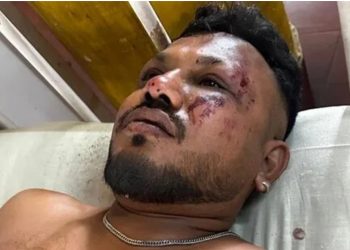 VIDEO+FOTO/ Ky është i mbijetuari i vetëm nga rrëzimi i aeroplanit në Indi, jep detaje nga ngjarja: Dëgjuam një zhurmë të madhe rreth 30 sekonda pas ngritjes!