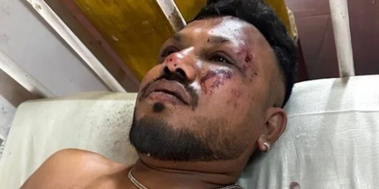 VIDEO+FOTO/ Ky është i mbijetuari i vetëm nga rrëzimi i aeroplanit në Indi, jep detaje nga ngjarja: Dëgjuam një zhurmë të madhe rreth 30 sekonda pas ngritjes!