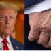 Shenja “e çuditshme” në dorën e Trump, ekspertët: Mund të jetë mavijosje për disa arsye! Shtëpia e Bardhë: Takon shumë amerikanë dhe u shtrëngon duart
