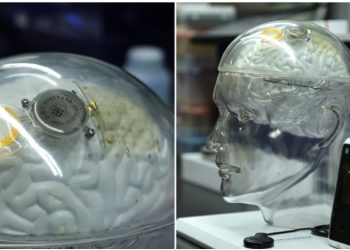 Kina po i afrohet SHBA-së në “teknologjinë e trurit”, rivalitet për kompaninë e Elon Musk?