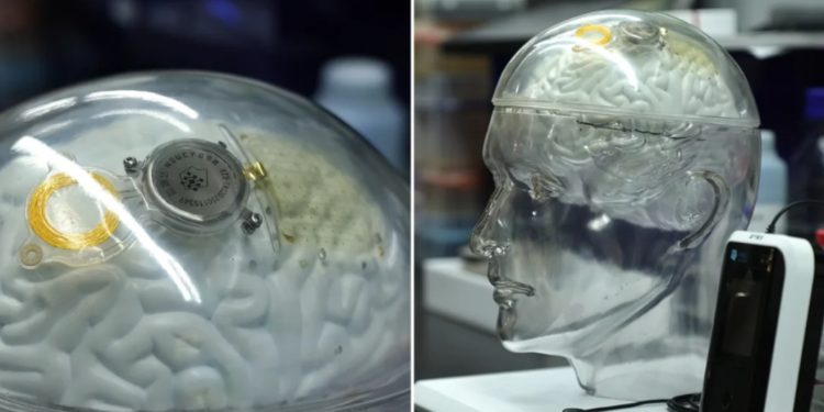 Kina po i afrohet SHBA-së në “teknologjinë e trurit”, rivalitet për kompaninë e Elon Musk?