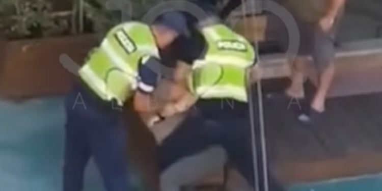 U prangos me dhunë nga policët, reagon qytetari: 6 javë njërën dorë në allçi! Denoncova sjelljet abuzive të uniformave dhe e gjitha m’u kthye si bumerang