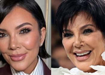 100 mijë dollarë 'lifting'! Kris Jenner diskuton hapur për estetikën: Dua të jem më e mira që mundem.