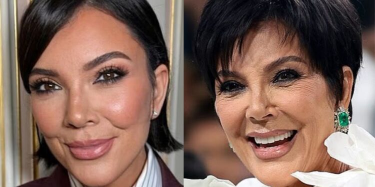 100 mijë dollarë 'lifting'! Kris Jenner diskuton hapur për estetikën: Dua të jem më e mira që mundem.