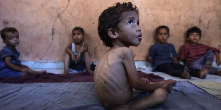 "Amnesty International" akuzon Izraelin: Po zbatohet një politikë e qëllimshme për të shkaktuar uri në Gazë!