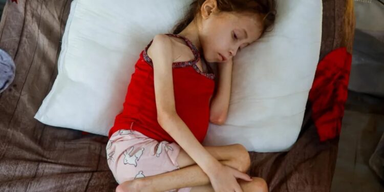 Deputetët britanikë kërkojnë evakuimin e menjëhershëm të fëmijëve të sëmurë dhe të plagosur nga Gaza: Sillni ata tani për trajtim.