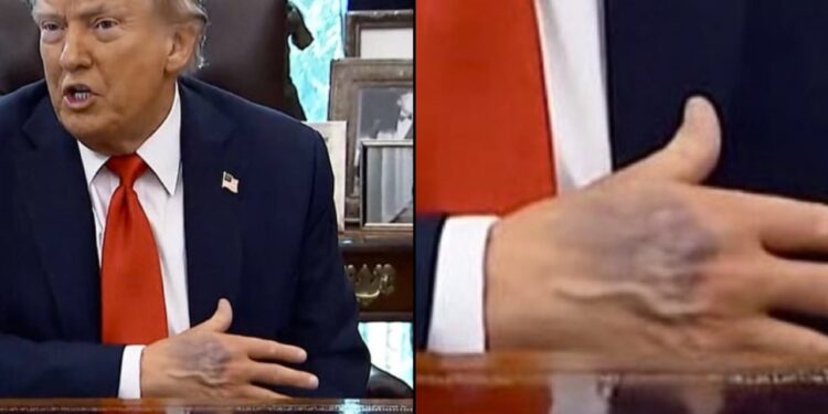 Foto e Donald Trumpit e publikuar në rrjet, Shtëpia e Bardhë jep informacione mbi shëndetin e Presidentit amerikan.