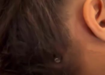 Vogëlushja shpëton mrekullisht në Gaza, plumbi nuk i depërton në kafkë 