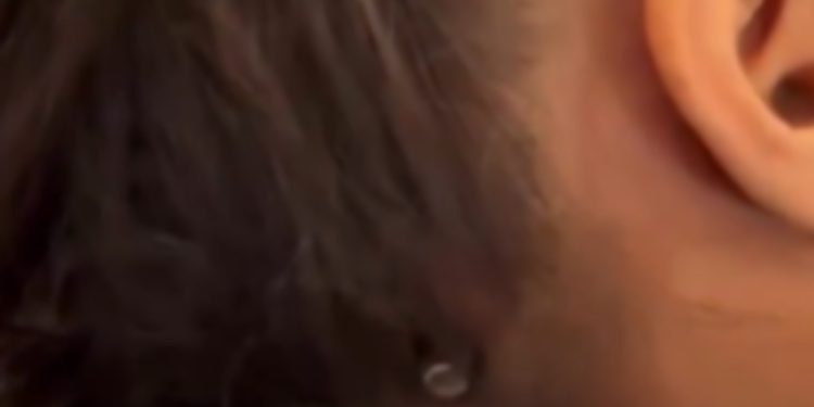 Vogëlushja shpëton mrekullisht në Gaza, plumbi nuk i depërton në kafkë