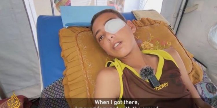 “Nuk kishim ushqim në shtëpi”/ Dëshmia rrënqethëse e 15-vjeçarit që u qëllua në sy teksa kërkonte ushqim në Gaza: U rrëzova përtokë, mendova se ky ishte fundi im