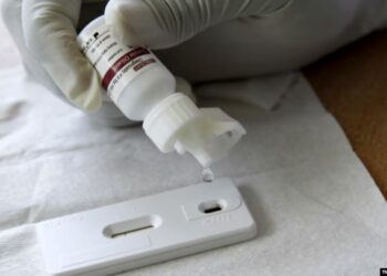 Një person humb jetën, 19 raste të reja me HIV raportohen këtë vit në Kosovë.