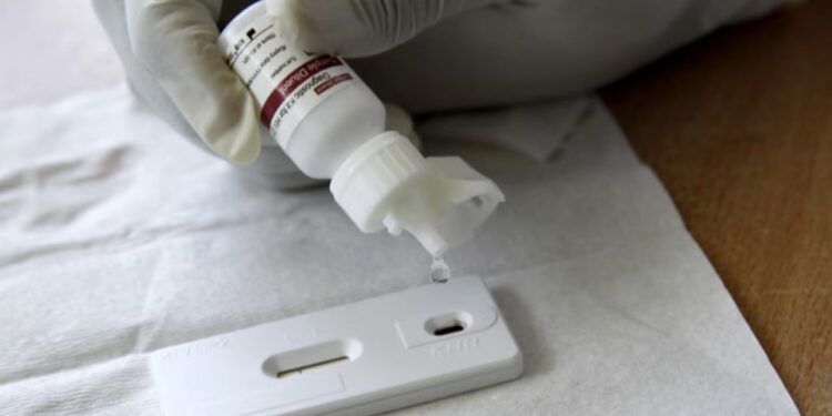 Një person humb jetën, 19 raste të reja me HIV raportohen këtë vit në Kosovë.