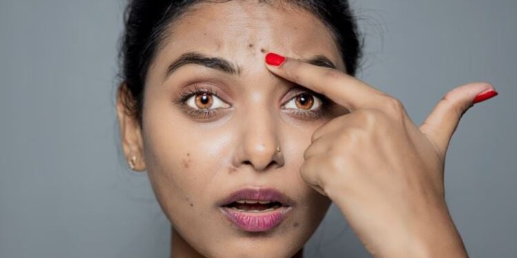 Thoni lamtumirë njollave dhe pikat e errëta në lëkurë falë një recete tradicionale indiane!