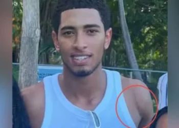 Tre muaj pa lojë, Bellingham tregon efektet e ndërhyrjes në shpatull.