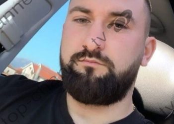 8 plumba ndaj Kristian Kolës, hetimet: Dy persona dyshohen për atentatin në Shkodër, motivet mbeten të paqarta.