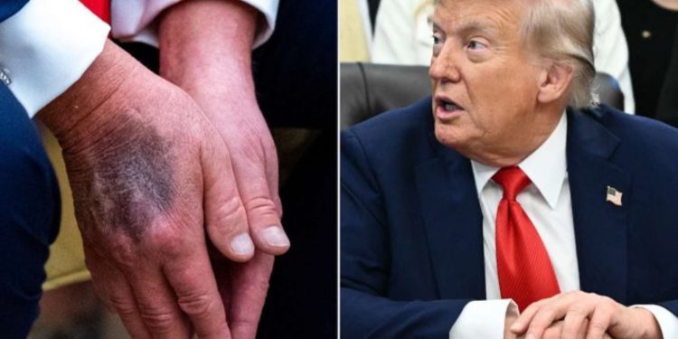 Teoritë konspirative për shëndetin e tij/ Trump: Nuk bëra asgjë për dy ditë dhe thanë se kisha vdekur, Biden nuk bëri asgjë për disa muaj dhe askush nuk tha se ka problem