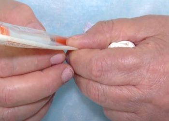 Traja të reja falas për mbrojtjen e syve/ Pacientët me diabet dhe retinopati përfitojnë nga terapia që parandalon verbimin.