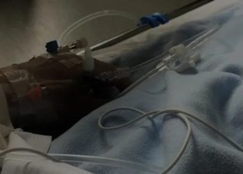 Viktima e plumbave nga atentati në Shkodër, familja e kamerieres 25-vjeçare kërkon ndihmë për shërimin e saj