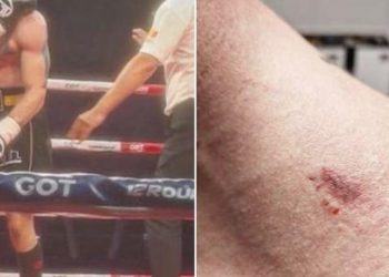 Boksieri shqiptar me stilin e Mike Tyson, siguron fitoren përmes nokautit teknik, ndërsa rivalizuesi serb ankohet: Më kafshoi…