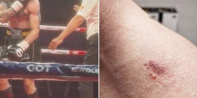 Boksieri shqiptar me stilin e Mike Tyson, siguron fitoren përmes nokautit teknik, ndërsa rivalizuesi serb ankohet: Më kafshoi…