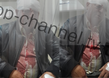 Dhunuan 61-vjeçarin me mjete të forta, arrestohen dy të dyshuar me histori kriminale.