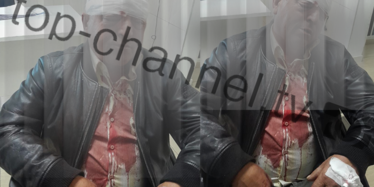 Dhunuan 61-vjeçarin me mjete të forta, arrestohen dy të dyshuar me histori kriminale.