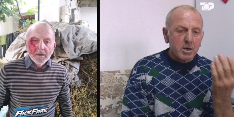 Fiks Fare: Familja në Devoll përjeton dhunë, por policia e lë të lirë autorin. Ekspertiza nga mjeku ligjor vonon.
