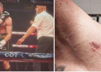 Belgjikë, boksieri shqiptar kafshon kundërshtarin serb, por fiton ndeshjen!