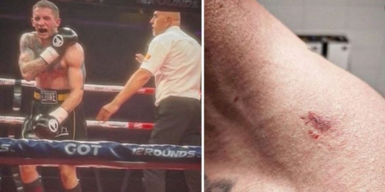 Belgjikë, boksieri shqiptar kafshon kundërshtarin serb, por fiton ndeshjen!