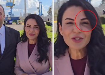 Zv.kryeministrja shfaqet me sy të nxirë, çfarë po ndodh me Ballukun?