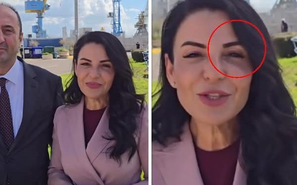 Zv.kryeministrja shfaqet me sy të nxirë, çfarë po ndodh me Ballukun?