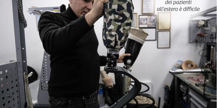 Ukraina transformohet në qendër globale për prodhimin e protezave, me 100 mijë individë që kanë pësuar dëmtime.