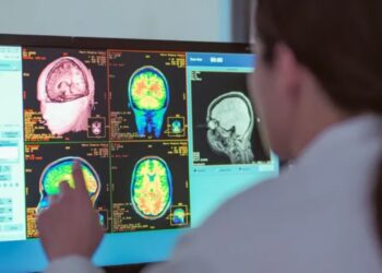 Adoleshenca vazhdon deri në moshën 30 vjeçare, një studim i ri përcakton katër faza të rëndësishme në zhvillimin e trurit.