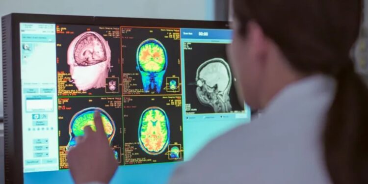 Adoleshenca vazhdon deri në moshën 30 vjeçare, një studim i ri përcakton katër faza të rëndësishme në zhvillimin e trurit.